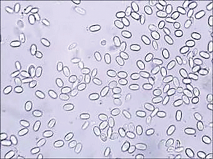 A Closer Look- Impact of Nosema Disease | Bee Culture