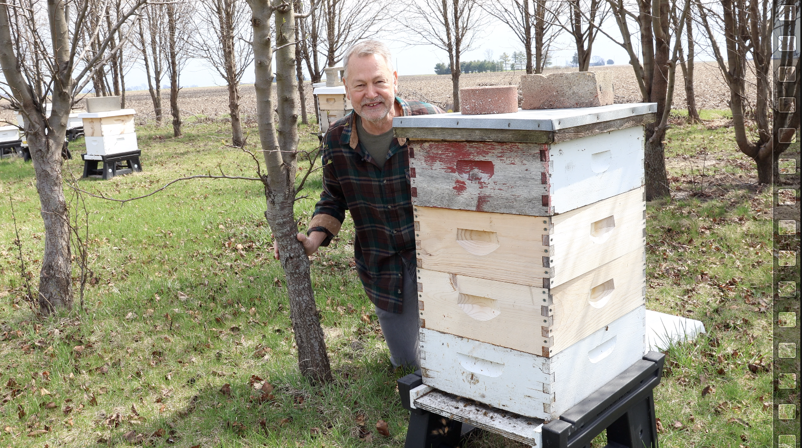 David Burns with hives